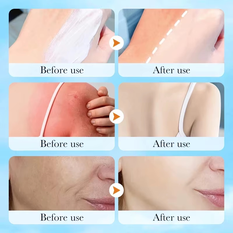 Korean SKIN1004 Centella Air-F - Skincare Skin 1004 recension och pris