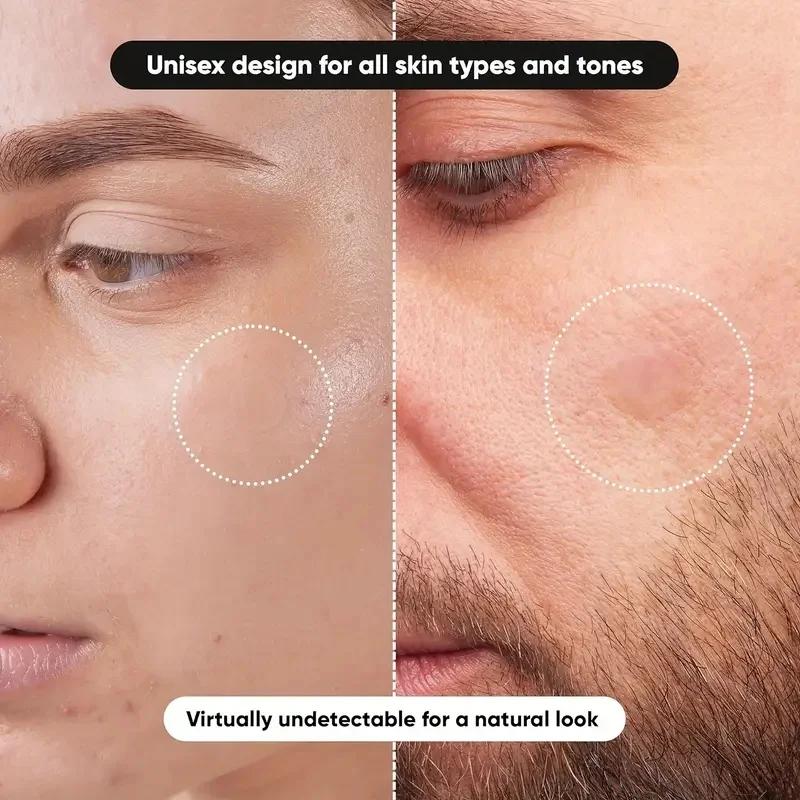 360 pieces/box acne patches -  - Skincare The Originote recension och pris